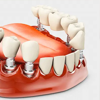 پروتز دندان در مطب دکتر عباسپور